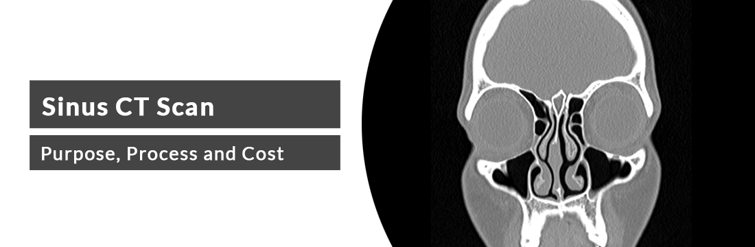 Sinus CT Scan: Purpose, Process and Cost